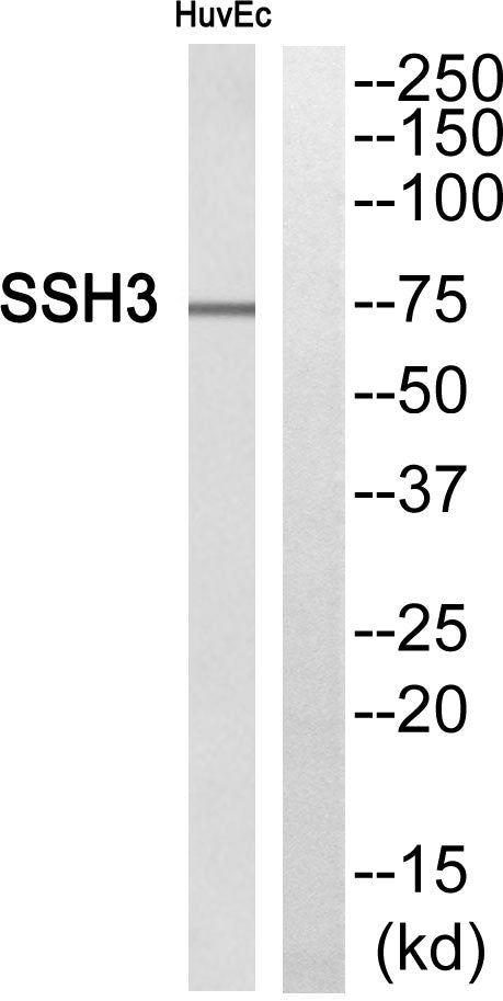 SSH3 Rabbit Polyclonal Antibody