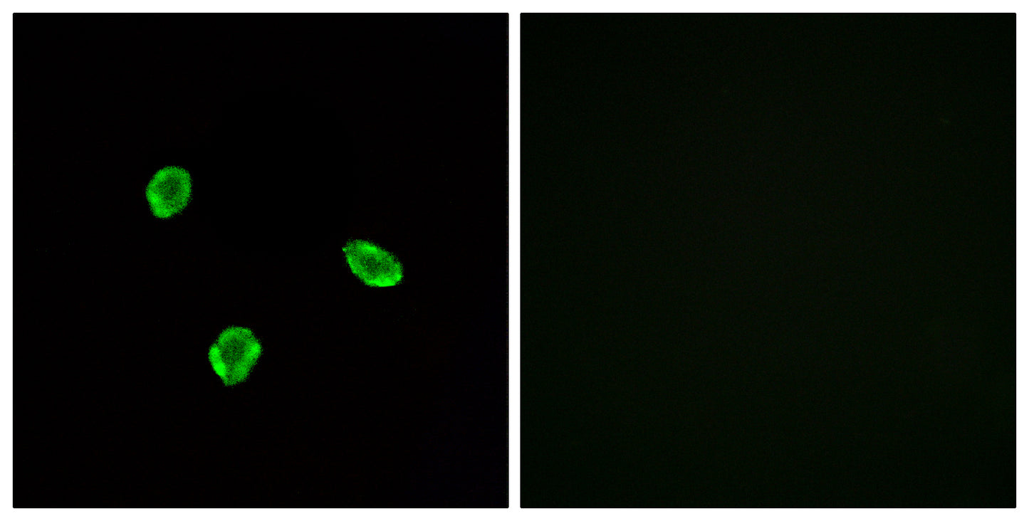 SSTR1 Rabbit Polyclonal Antibody