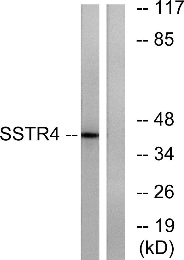 SSTR4 Rabbit Polyclonal Antibody