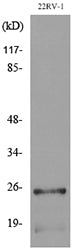 SSX Rabbit Polyclonal Antibody