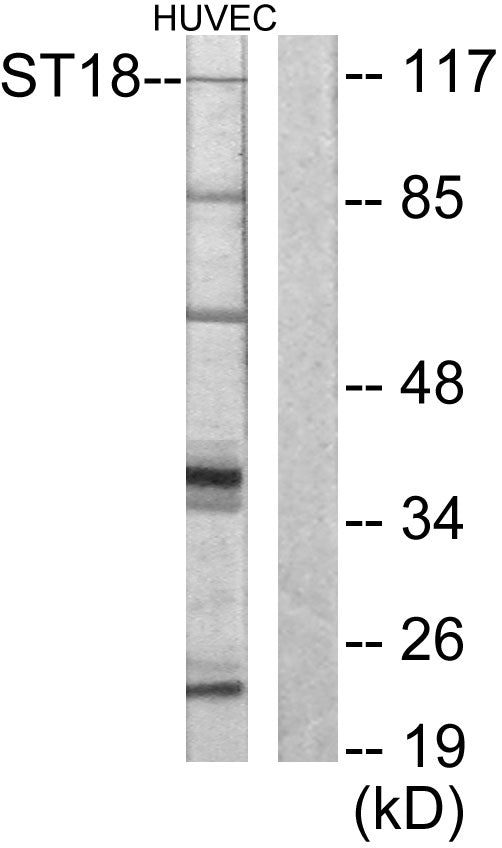 ST18 Rabbit Polyclonal Antibody