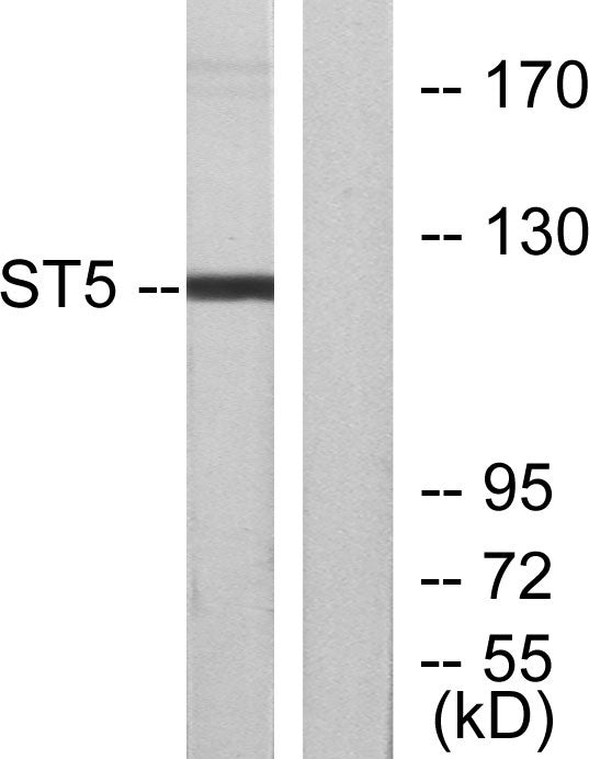 ST5 Rabbit Polyclonal Antibody