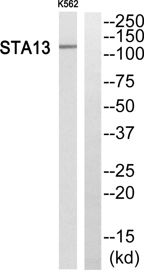 StARD13 Rabbit Polyclonal Antibody