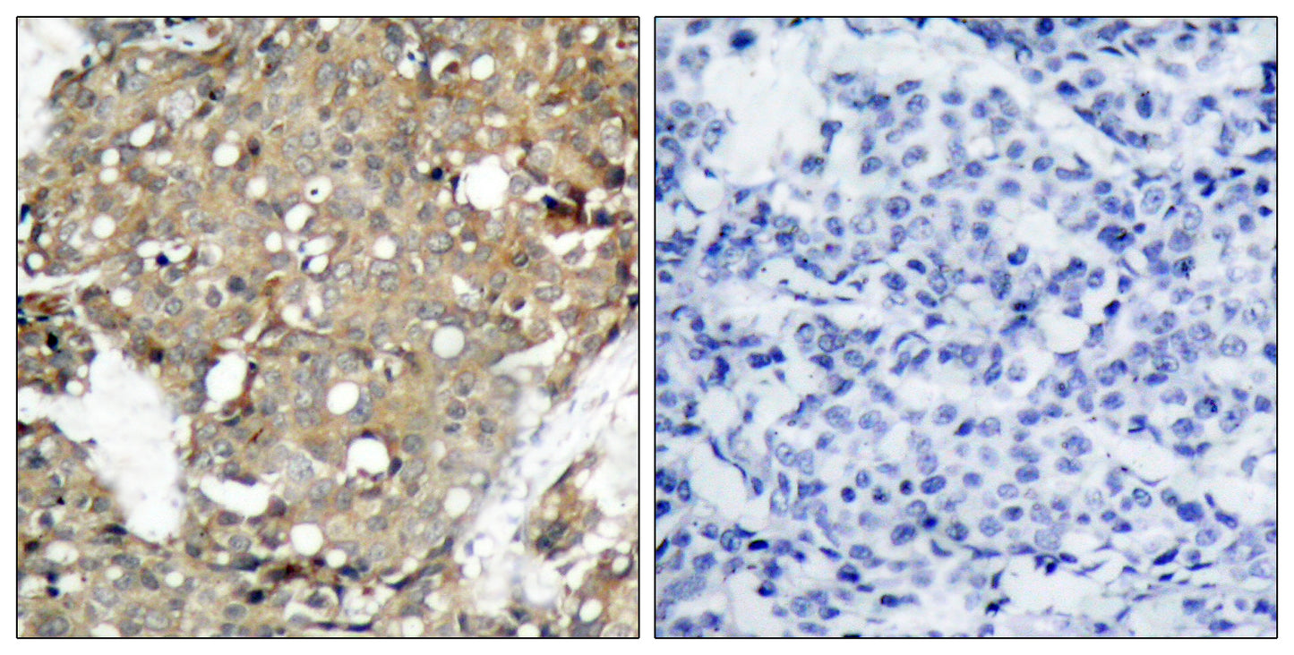 Stat1 Rabbit Polyclonal Antibody