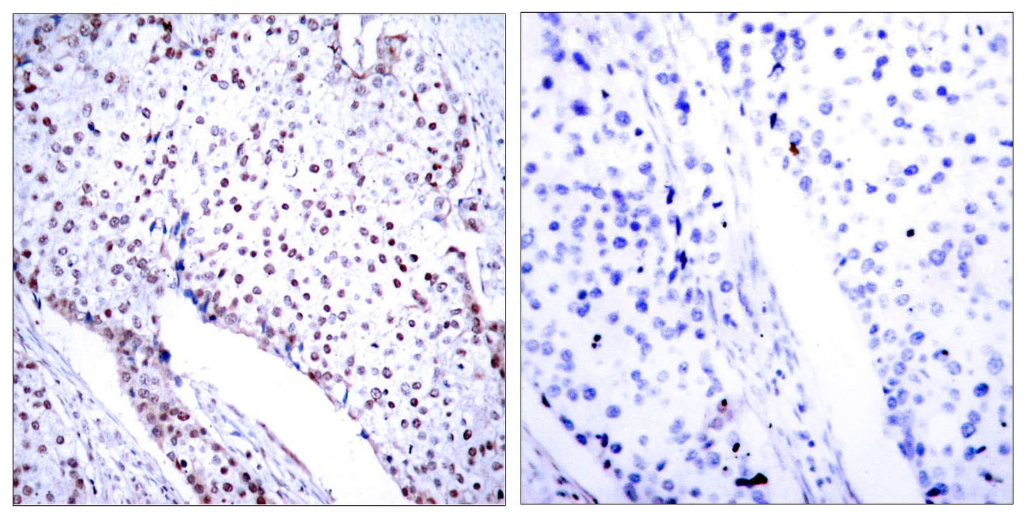 Stat3 Rabbit Polyclonal Antibody