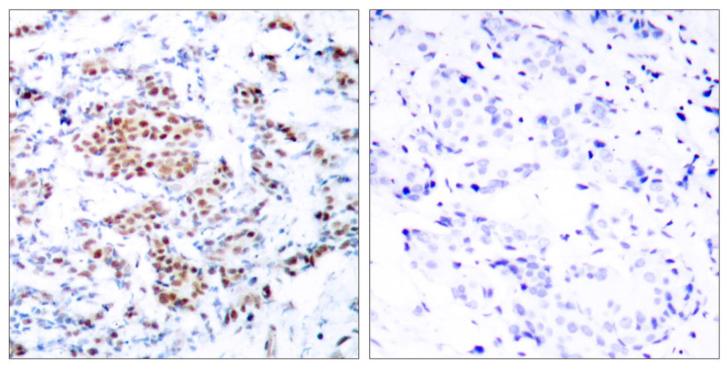 Stat5 Rabbit Polyclonal Antibody
