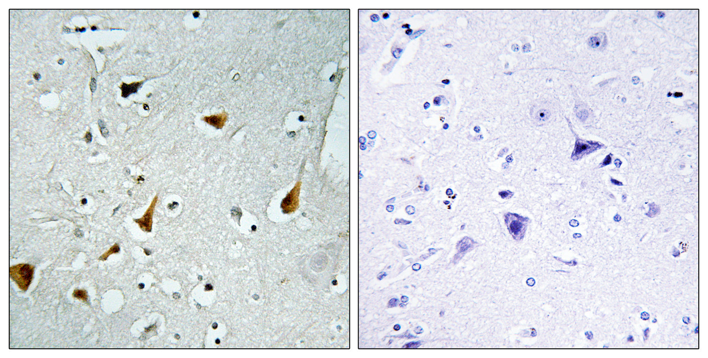Stat6 Rabbit Polyclonal Antibody