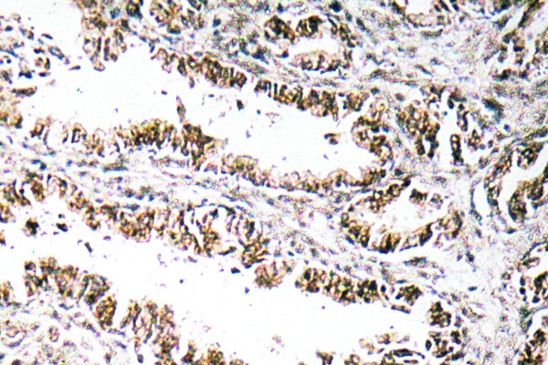 STEAP1 Rabbit Polyclonal Antibody
