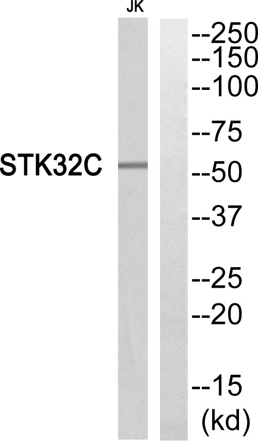 STK32C Rabbit Polyclonal Antibody