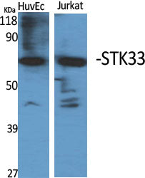STK33 Rabbit Polyclonal Antibody