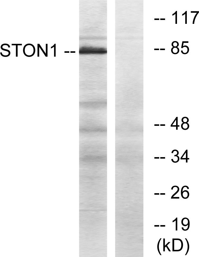 Stonin-1 Rabbit Polyclonal Antibody