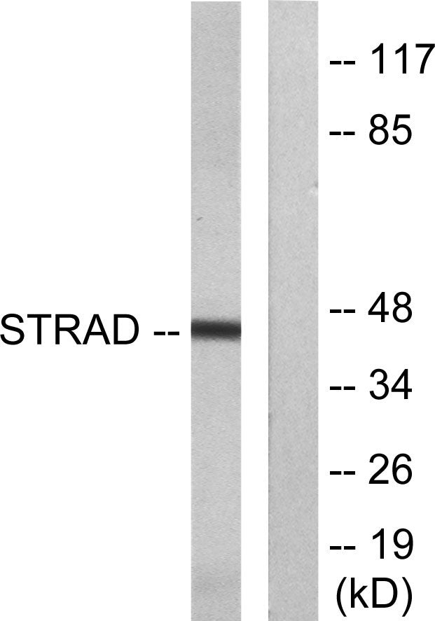 Strad Rabbit Polyclonal Antibody