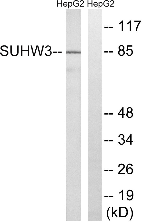 SUHW3 Rabbit Polyclonal Antibody