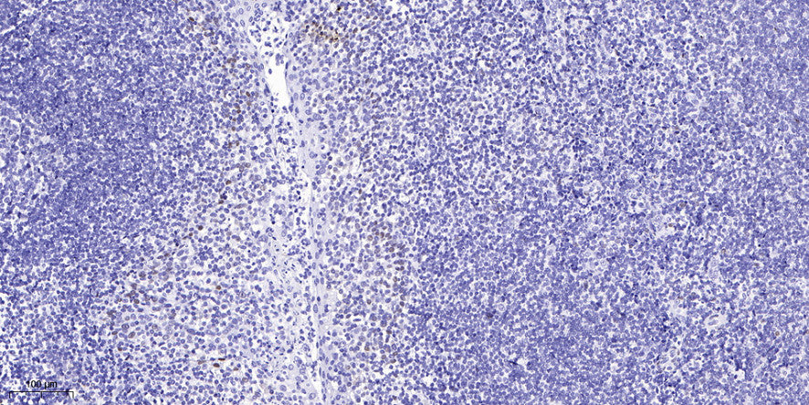 SUHW4 Rabbit Polyclonal Antibody