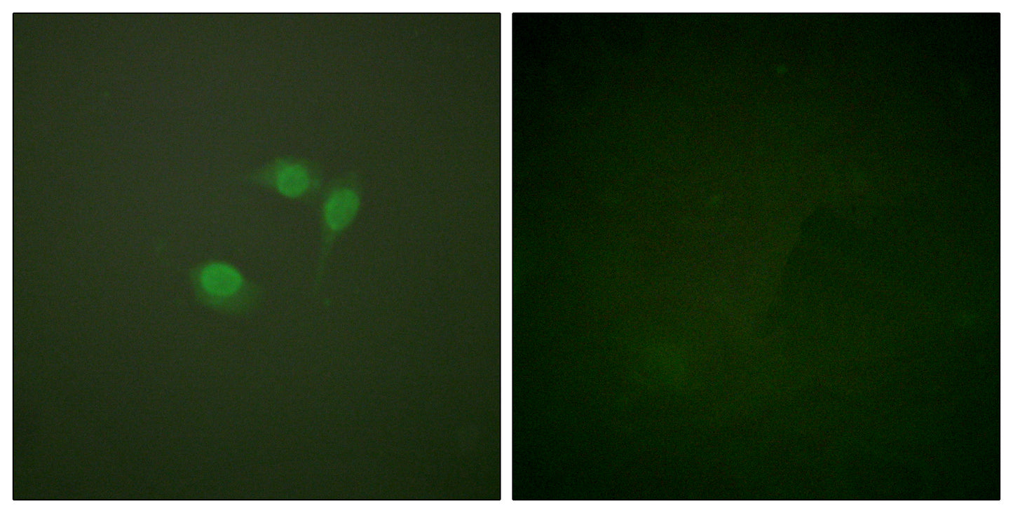 SUMO-1 Rabbit Polyclonal Antibody