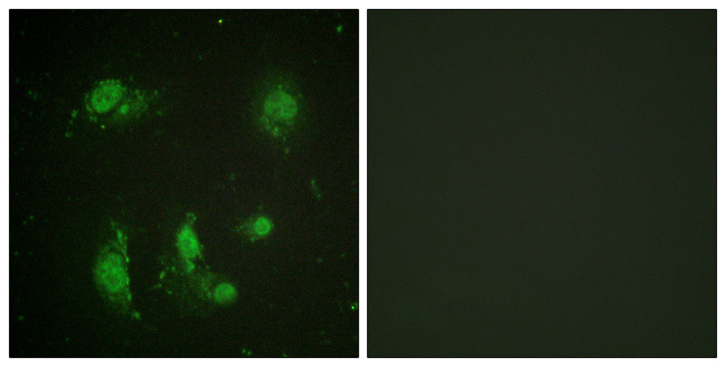 Survivin Rabbit Polyclonal Antibody