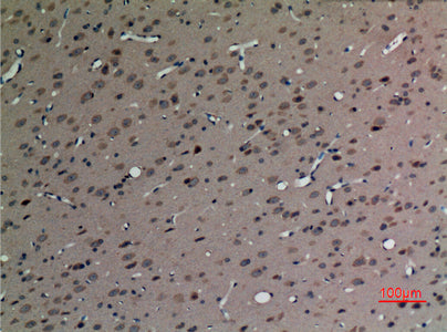 SV2C Rabbit Polyclonal Antibody