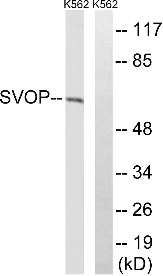 SVOP Rabbit Polyclonal Antibody