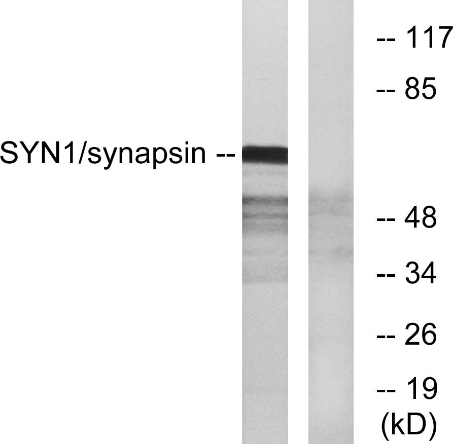 Synapsin I Rabbit Polyclonal Antibody