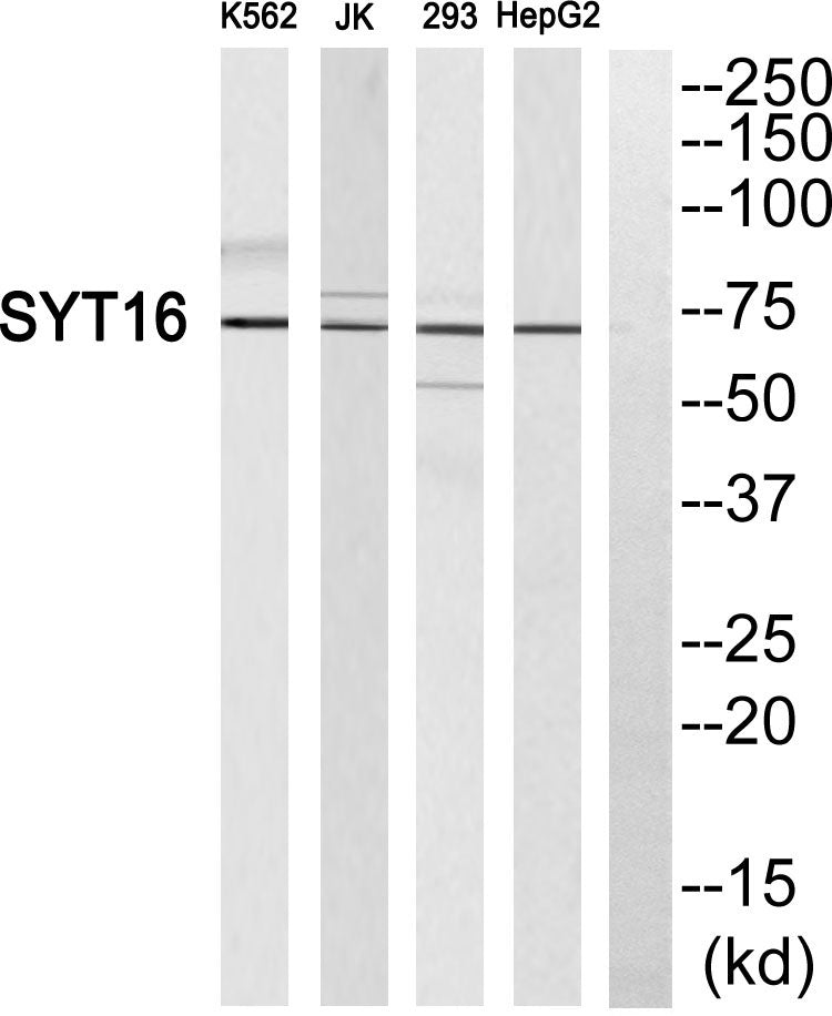 Synaptotagmin XVI Rabbit Polyclonal Antibody