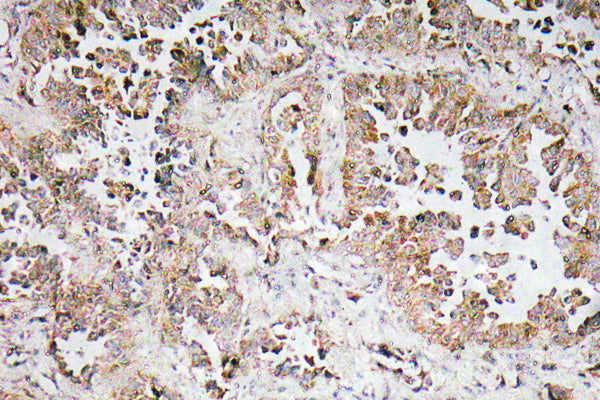 Synphilin-1 Rabbit Polyclonal Antibody