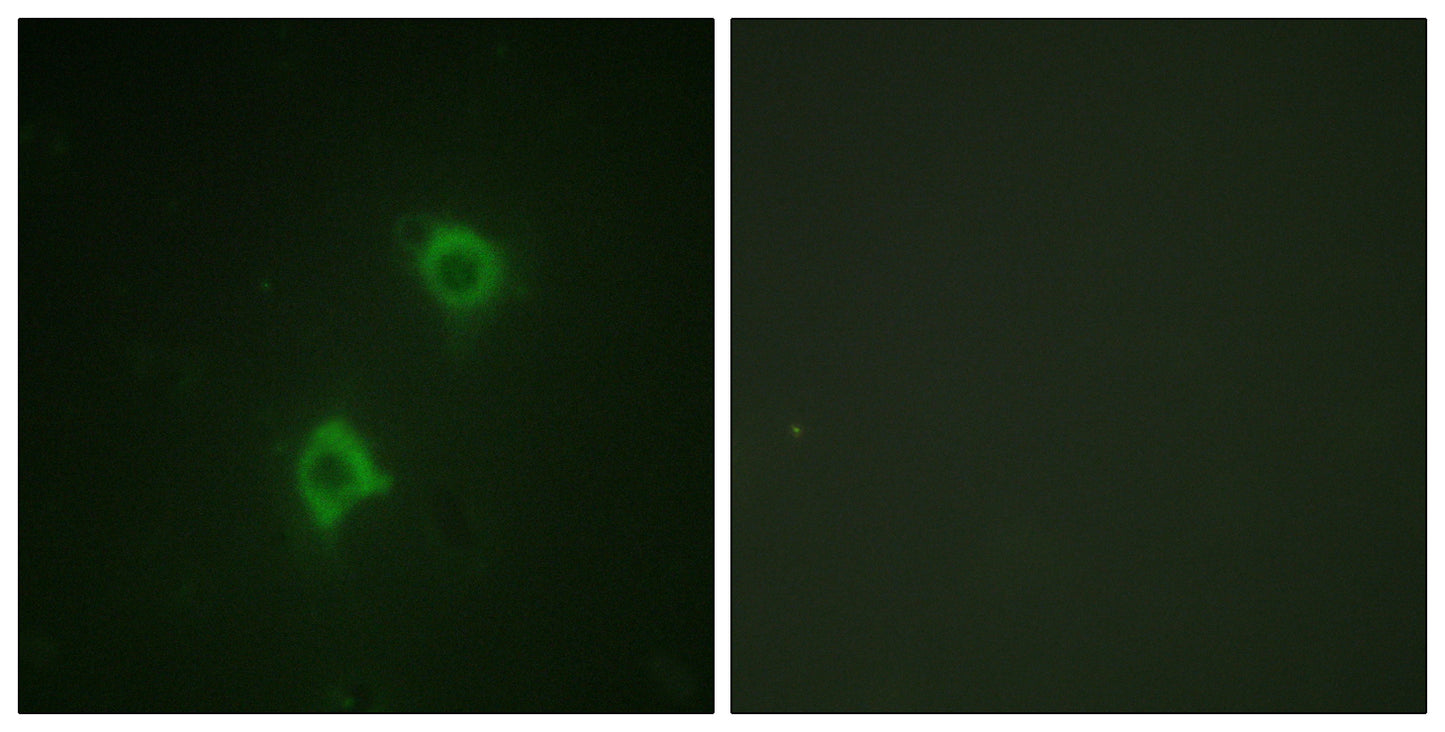Syntaxin 1 Rabbit Polyclonal Antibody
