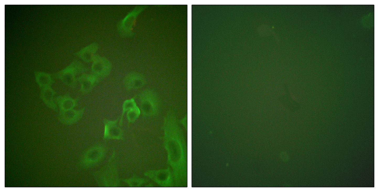 Synuclein-β Rabbit Polyclonal Antibody