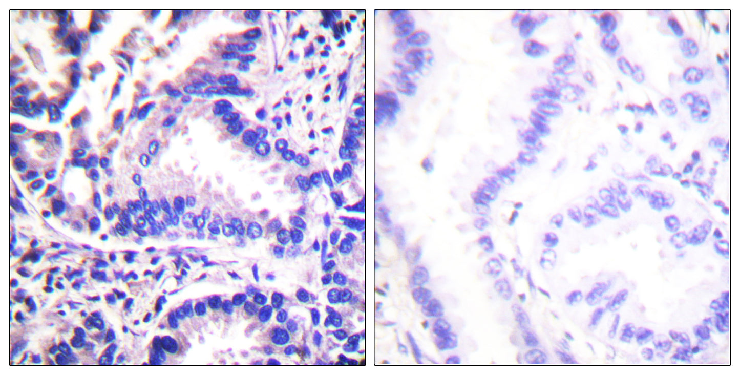 Synuclein-γ Rabbit Polyclonal Antibody