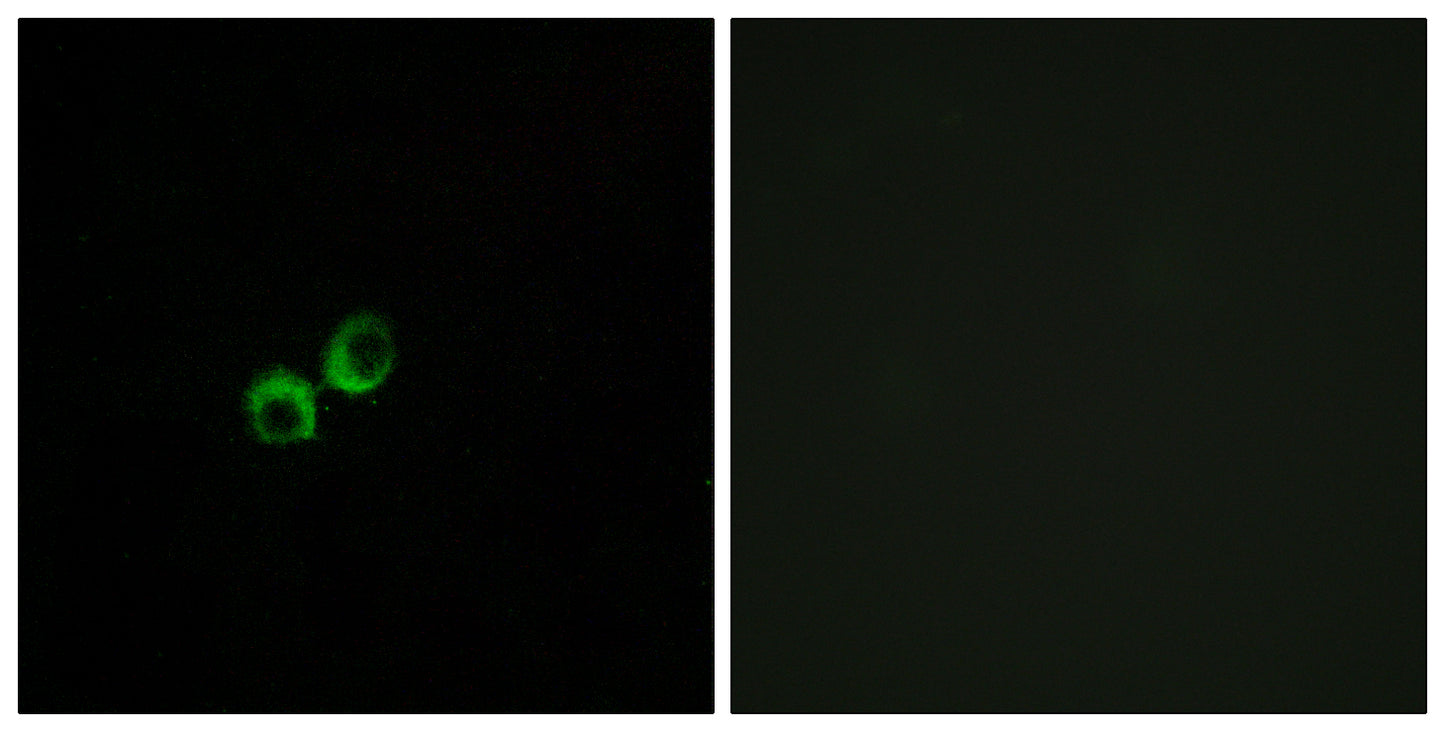 T1R3 Rabbit Polyclonal Antibody