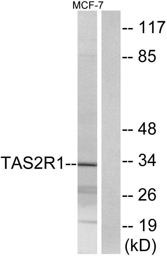 T2R1 Rabbit Polyclonal Antibody