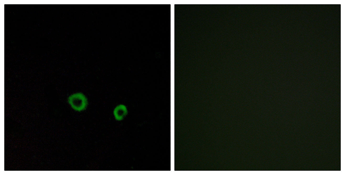 T2R10 Rabbit Polyclonal Antibody