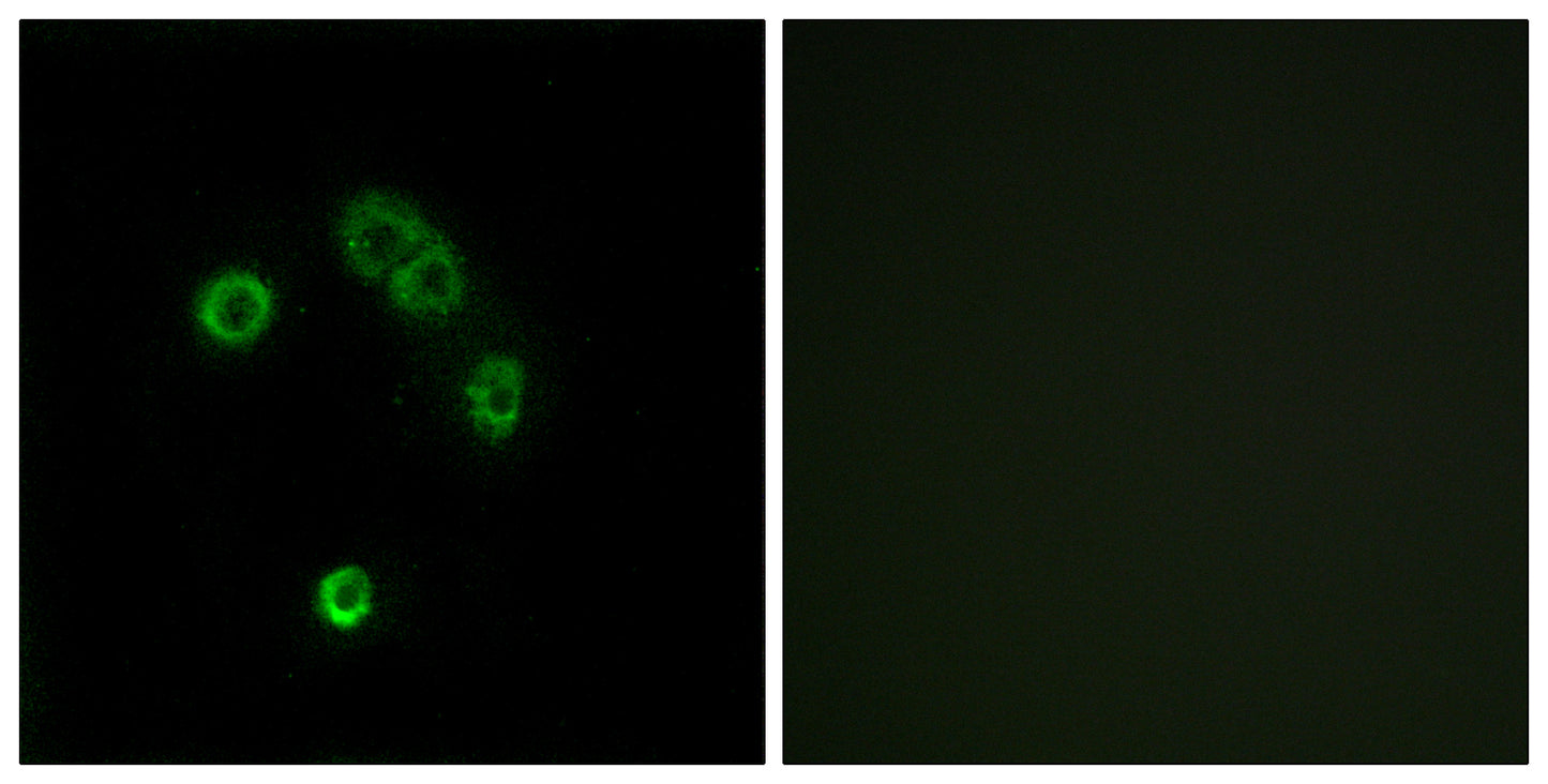 T2R13 Rabbit Polyclonal Antibody