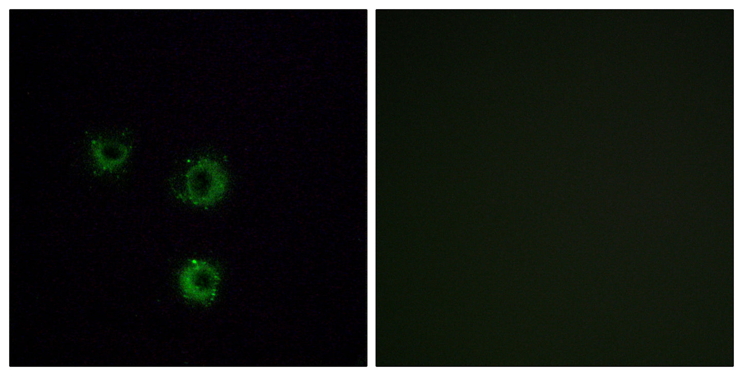 T2R14 Rabbit Polyclonal Antibody