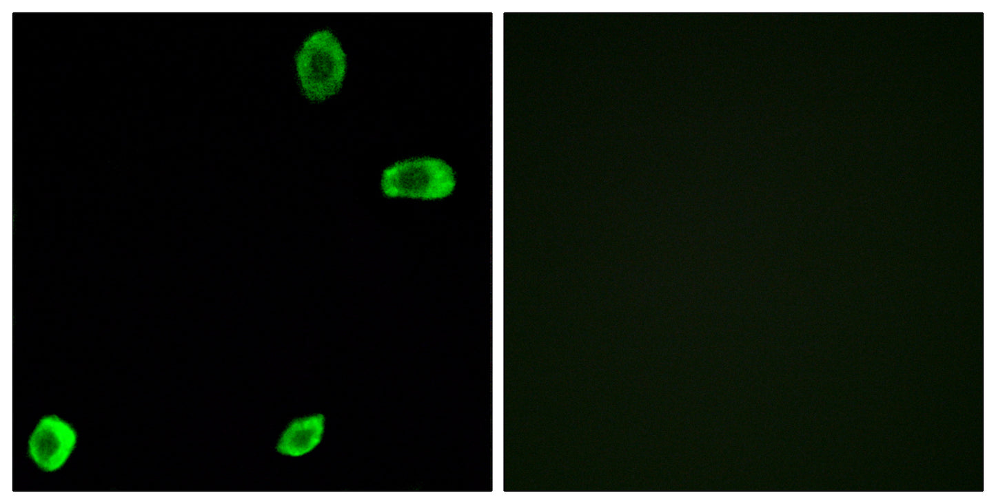 T2R39 Rabbit Polyclonal Antibody
