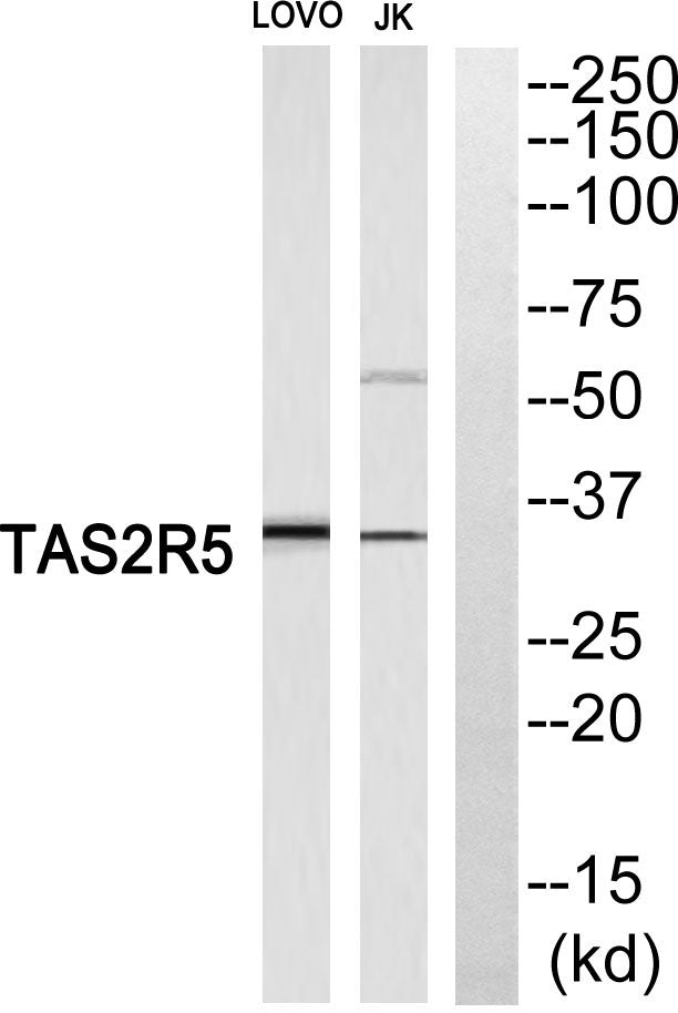 T2R5 Rabbit Polyclonal Antibody