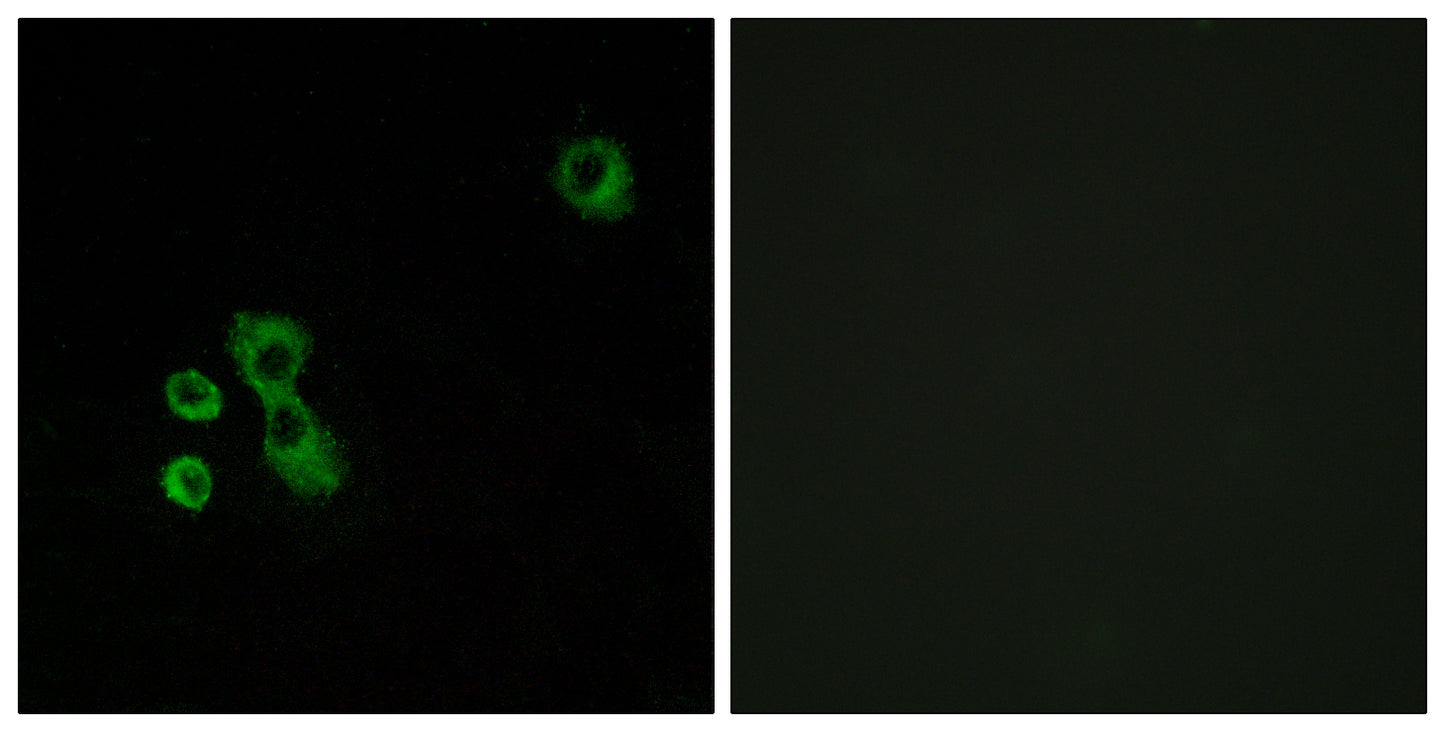 T2R7 Rabbit Polyclonal Antibody