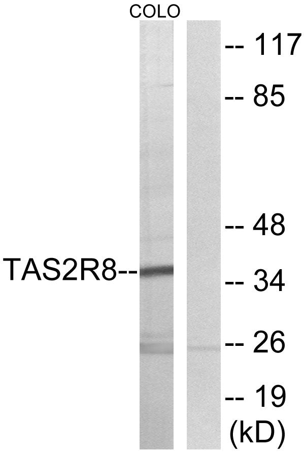 T2R8 Rabbit Polyclonal Antibody