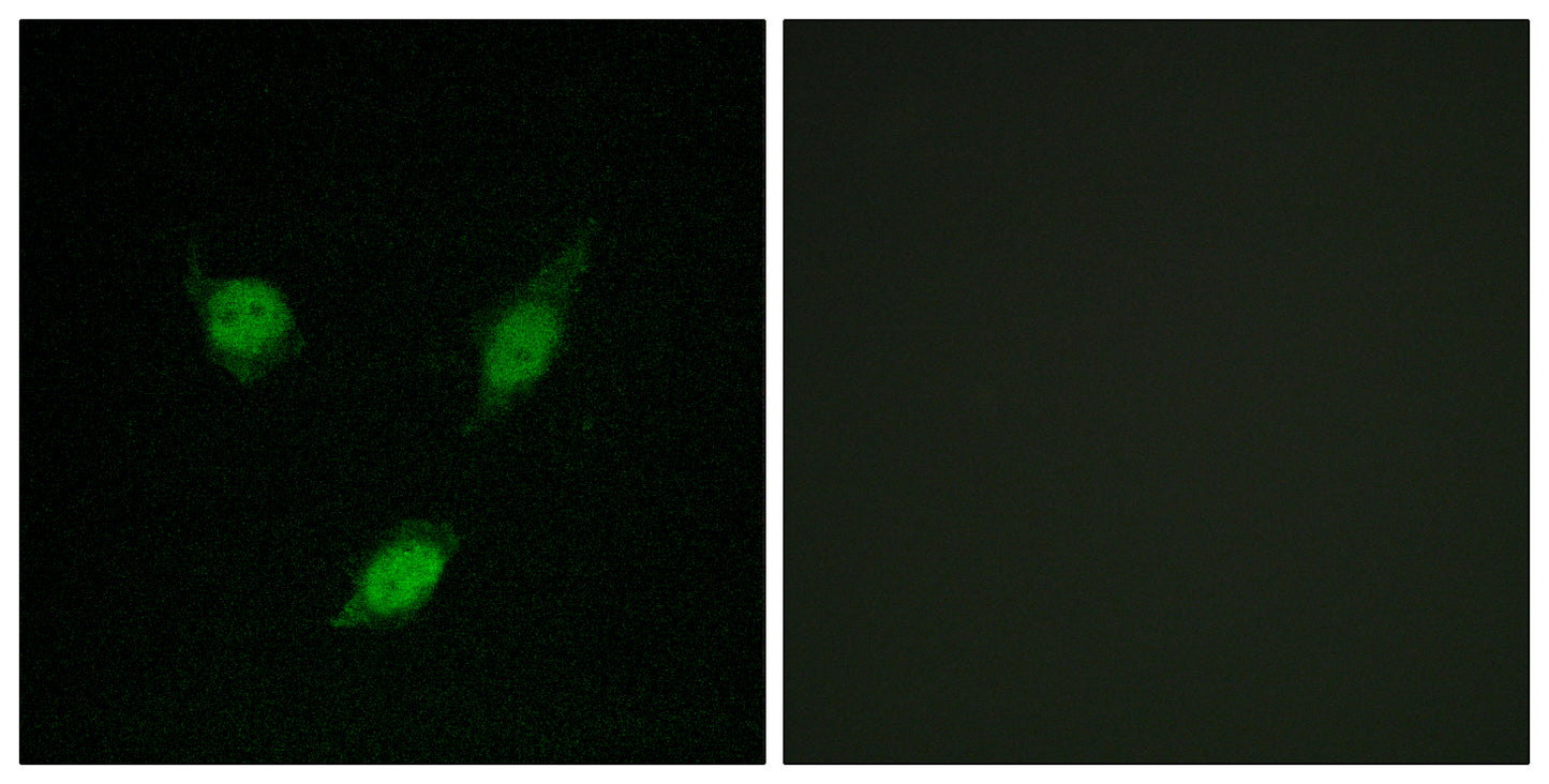 TACC1 Rabbit Polyclonal Antibody