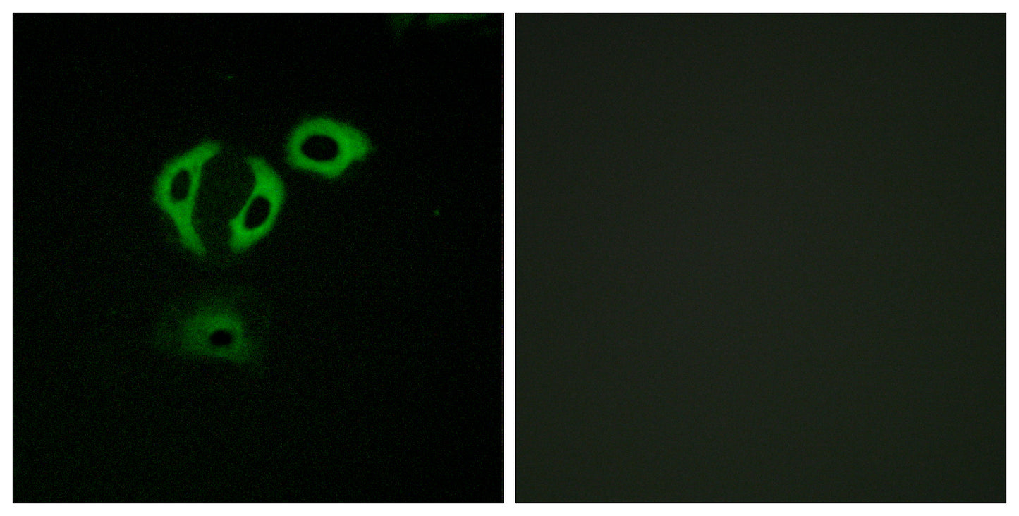 TACC3 Rabbit Polyclonal Antibody