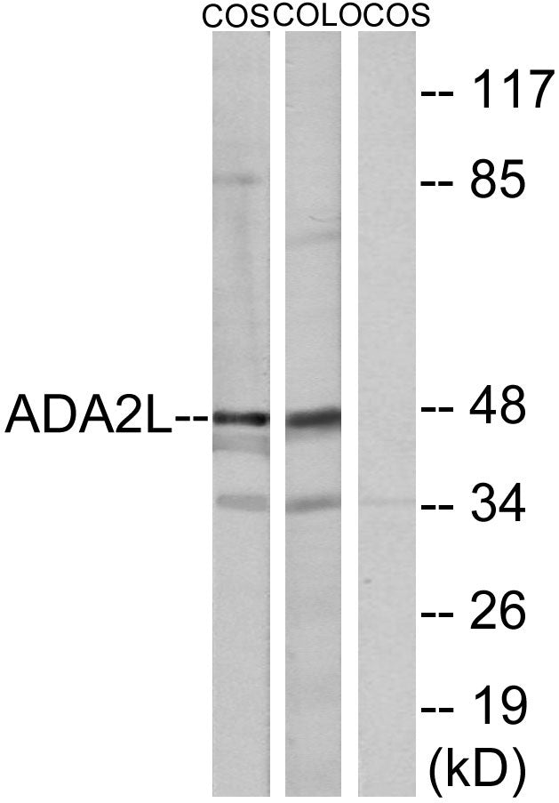 TADA2L Rabbit Polyclonal Antibody