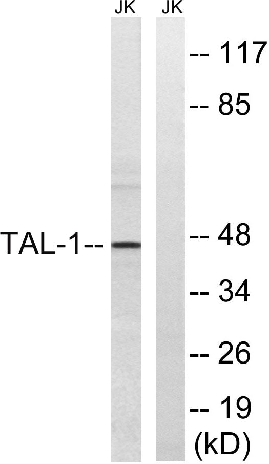 TAL1 Rabbit Polyclonal Antibody