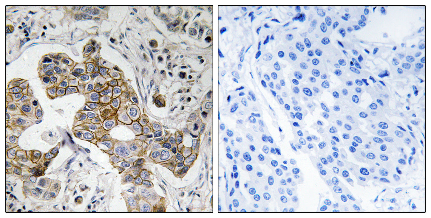 TASK-5 Rabbit Polyclonal Antibody