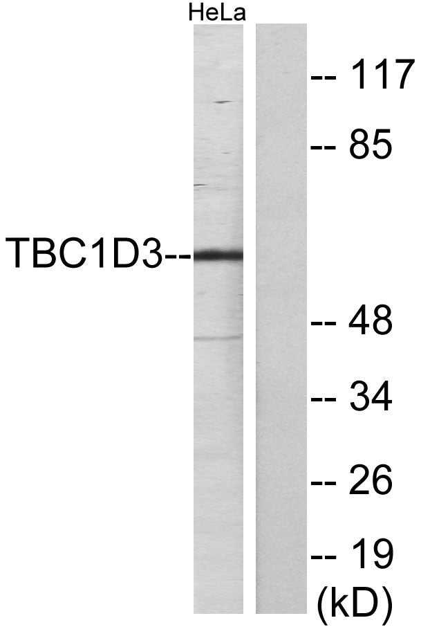 TBC1D3A/B/C Rabbit Polyclonal Antibody