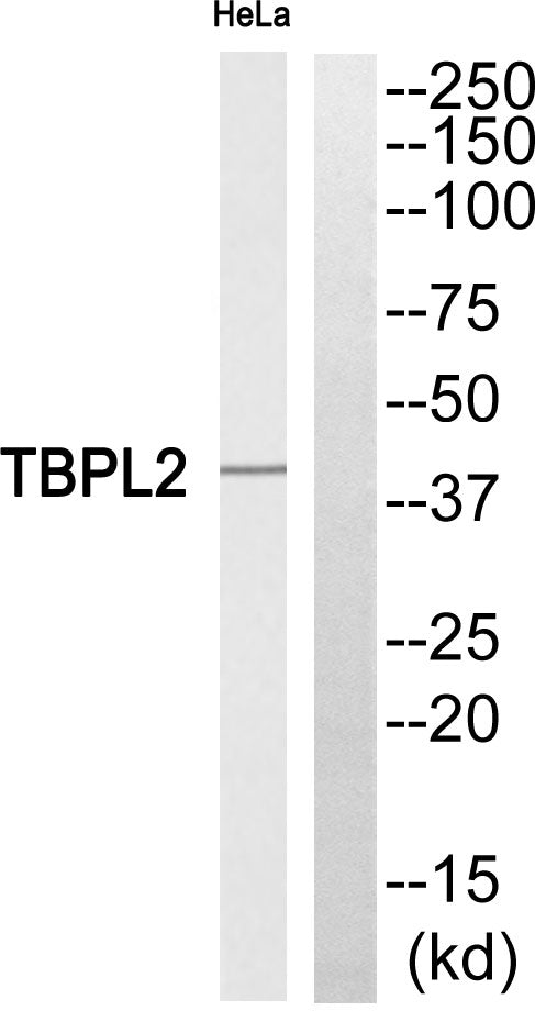 TBPL2 Rabbit Polyclonal Antibody