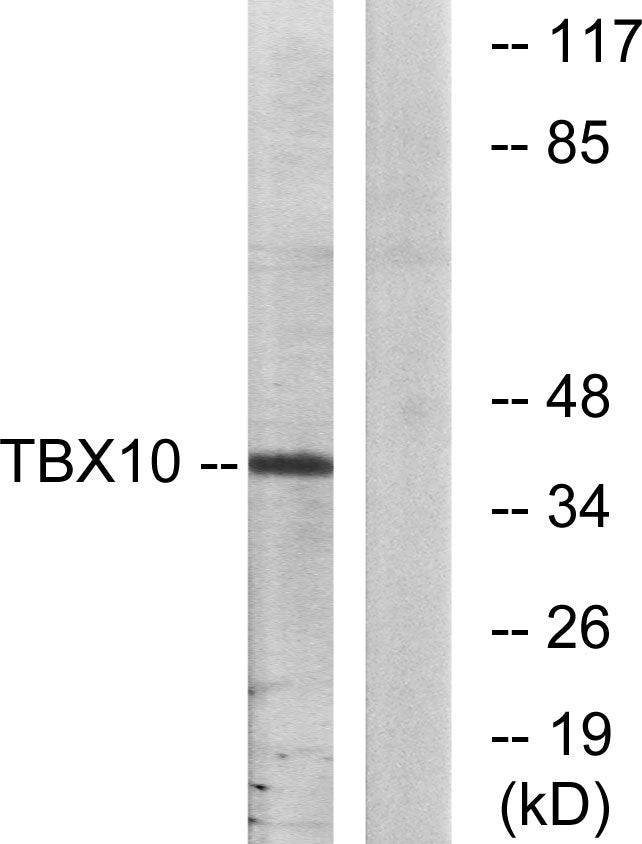 TBX10 Rabbit Polyclonal Antibody