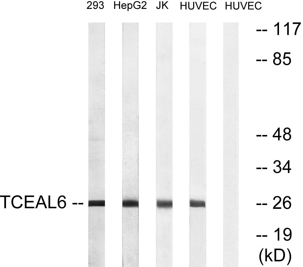 TCEAL6 Rabbit Polyclonal Antibody