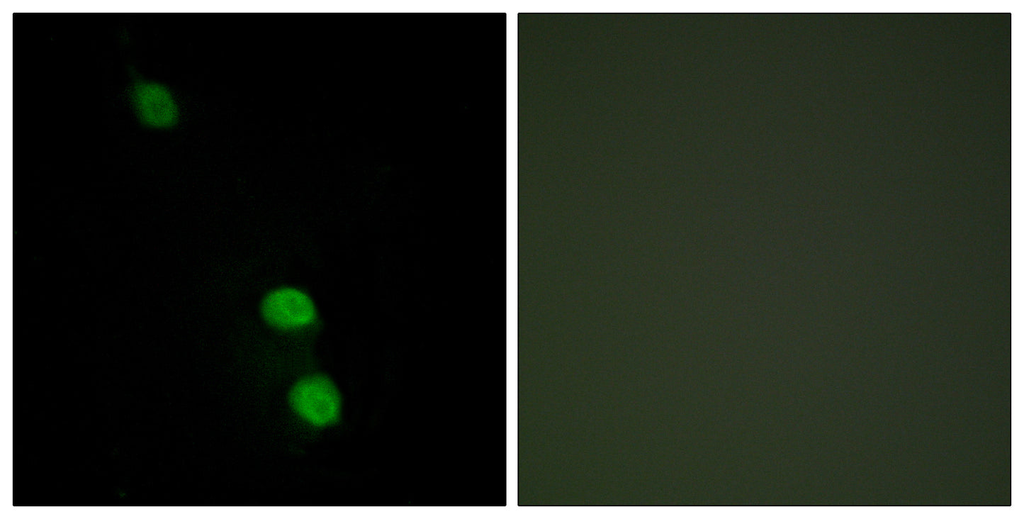 TEF-4 Rabbit Polyclonal Antibody