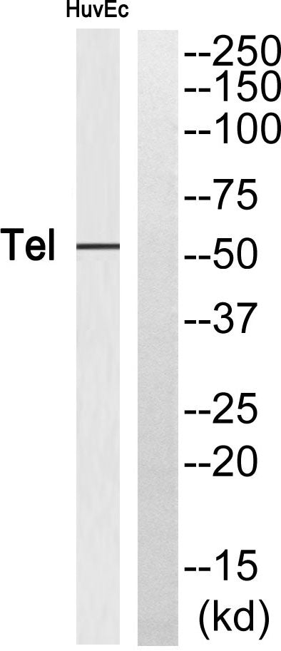 TEL Rabbit Polyclonal Antibody