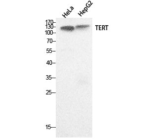 TERT Rabbit Polyclonal Antibody