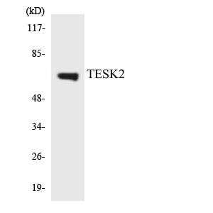 TESK2 Rabbit Polyclonal Antibody